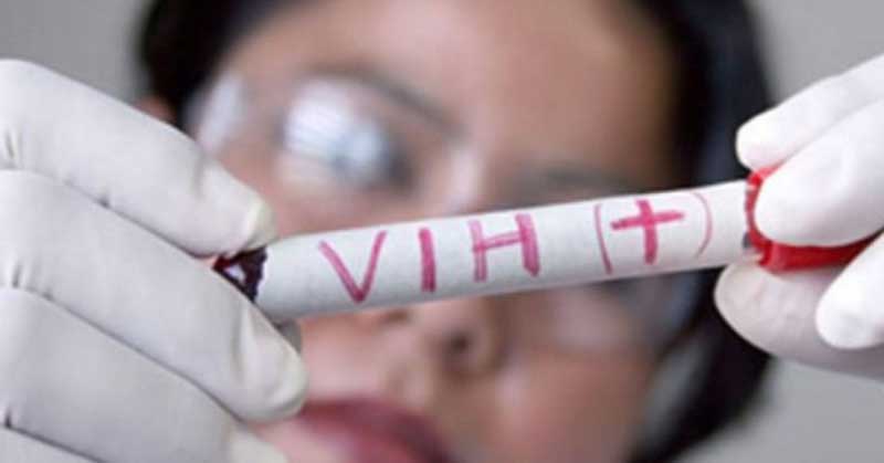 hiv - diagnóstico -SIDA
